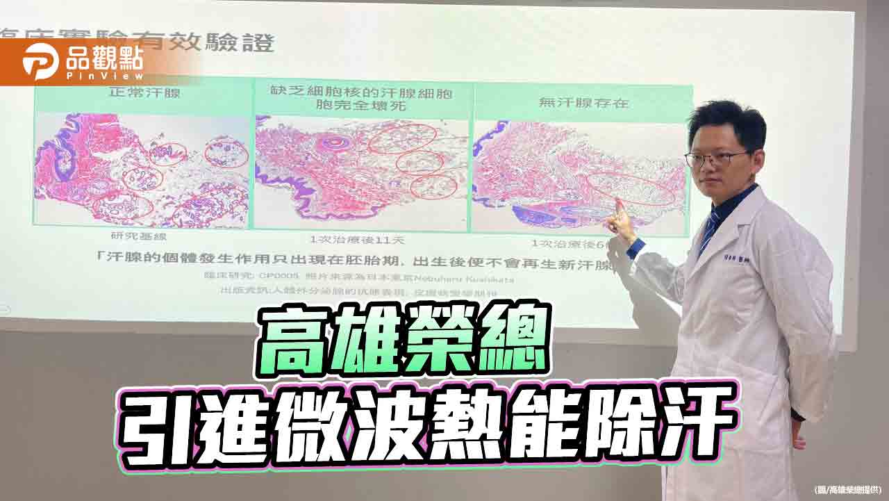 腋下多汗異味新療法   高雄榮總微波熱能除汗去狐臭