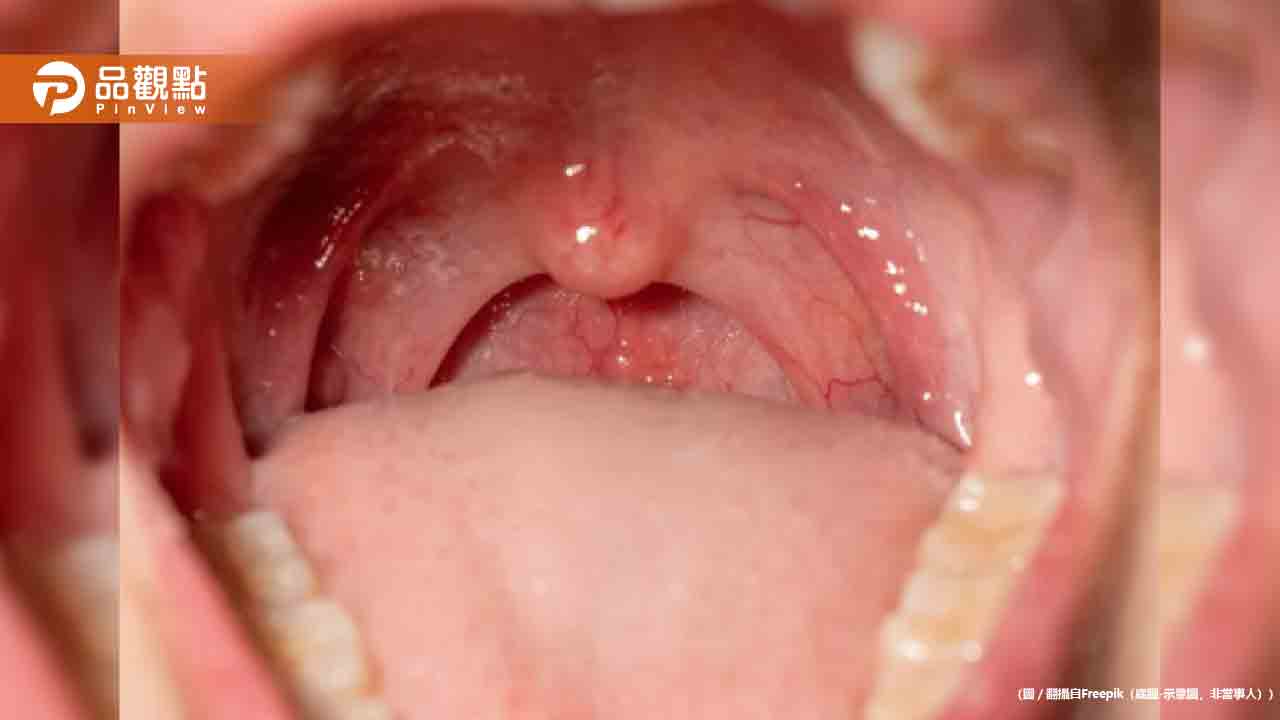 手機2分鐘揪口腔癌!台大AI快篩準確率破95% 2027年臨床應用