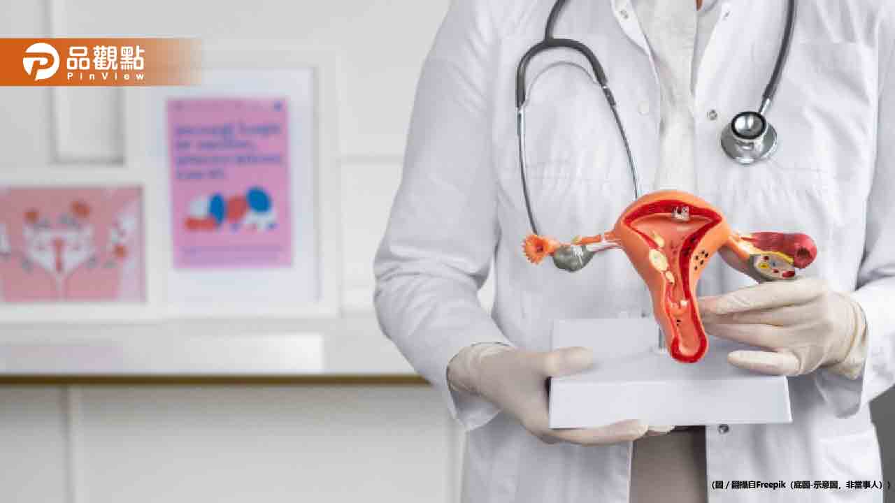 女性沉默殺手！卵巢癌初期偽裝「腸胃病」醫曝恐怖存活率
