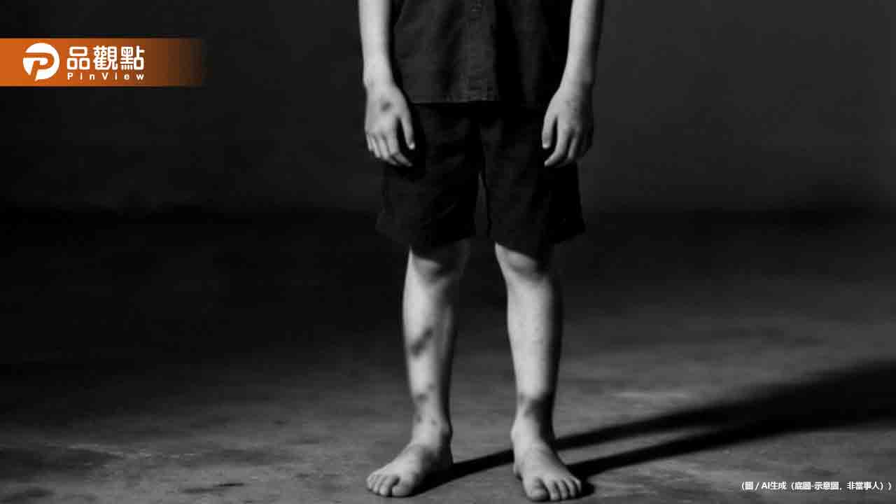 男童全身瘀青送急診！白血球飆百倍、併發腦出血不治